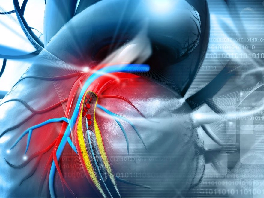 Kalp Bypass Ameliyatı Nedir, Nasıl Yapılır?