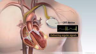 antalya cardiologist , antalya cardiology doctors , antalya kalp doktorları ,  doç. dr. fatih koç , fatih koç ,  antalya cardiology specialist, 
angio doctor antalya